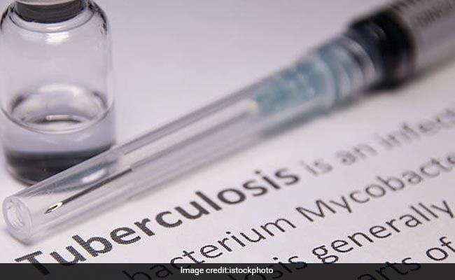 Woman Arrested After Refusing Tuberculosis Treatment For More Than A Year