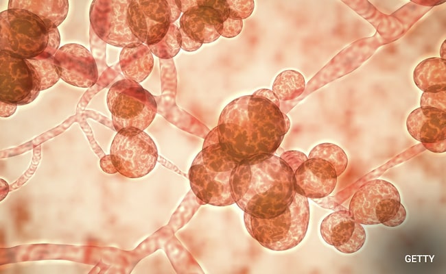 Deadly Fungal Infections Are Causing A "Silent Pandemic", Scientists Warn