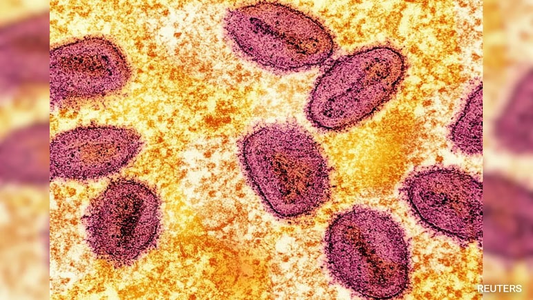 Africa Reports , Mpox Deaths, Warns Outbreak Is "Out Of Control"