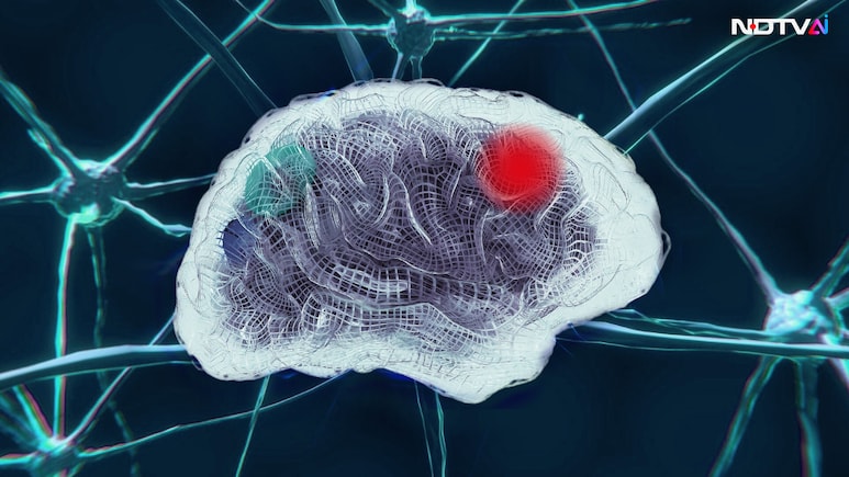 AI Model Detects Residual Brain Tumour In Seconds, Offers Real Time Guidance