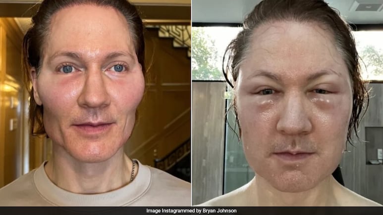 Bryan Johnson, Tech Millionaire Whose Anti Ageing Experiment Goes Wrong