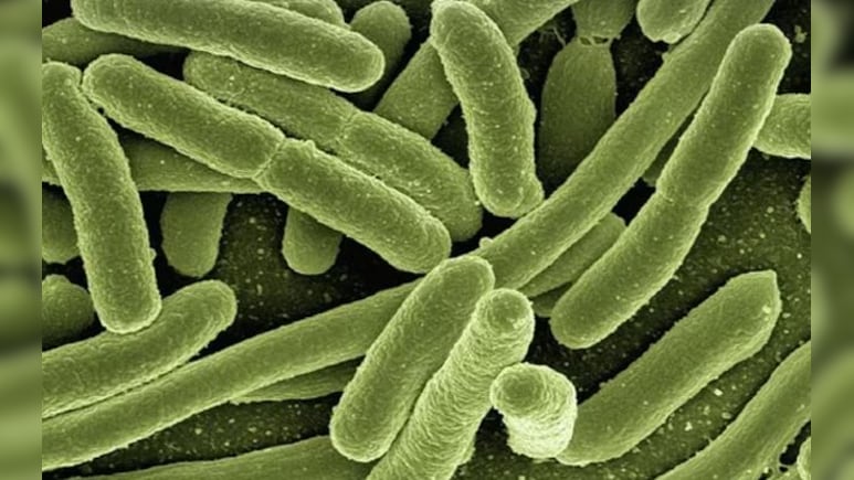 What Is "Bleeding Eye" Virus That Has Killed In Rwanda So Far