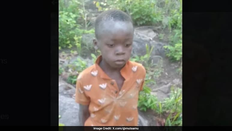 Boy, , Rescued After Day Survival In Lion Inhabited Zimbabwe Game Park