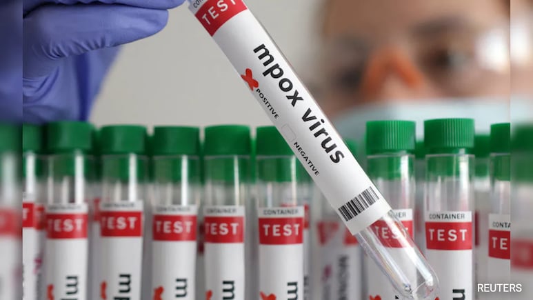 France Confirms First Case Of Mpox Variant