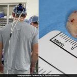 Canadian Surgeons Put 'Tooth' In Blind Woman's Eye To Restore Her Vision