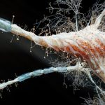Scientists Find Molecule That Blocks Brain Cell Death In Parkinson's, Alzheimer's